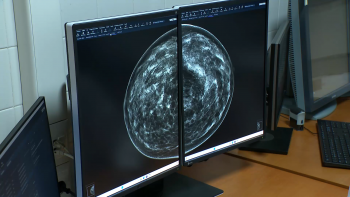 Novo Mamógrafo: Equipamento permite diagnóstico de precisão em 3D