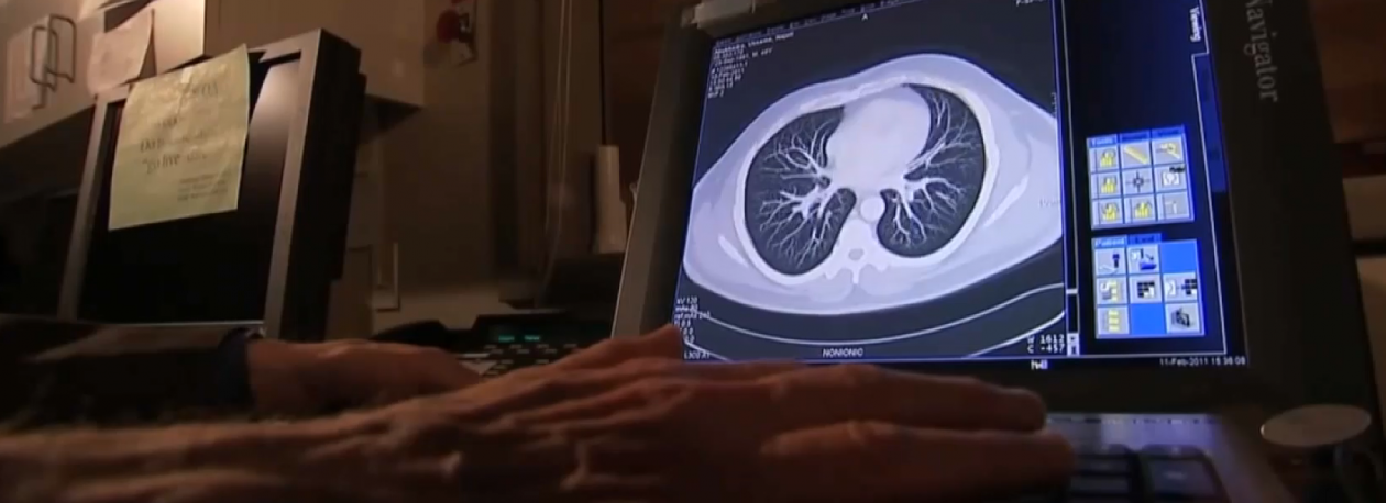 Imagem de Açores registaram taxa de sobrevivência ao cancro mais baixa do país