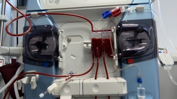 Imagem de Serviços de hemodiálise na Região vão continuar públicos e geridos pelos 3 hospitais