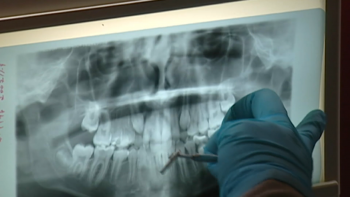 Imagem de Cheque-Dentista: Ordem dos Médicos Dentistas critica proposta do Chega
