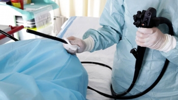 Imagem de Governo determina planos urgentes aos hospitais da Região para recuperar atrasos nas colonoscopias