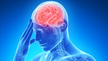 Imagem de Dia Mundial do AVC: Especialista alerta que prevenção é fator decisivo