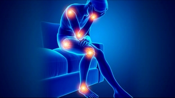 Imagem de Açores e Madeira com maior prevalência de algumas doenças reumáticas