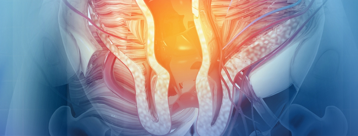 Imagem de Açores avançam com projeto inovador de medicina personalizada para cancro colorretal