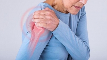 Imagem de Associação de Doentes de Dor Crónica alerta para urgência de estudo sobre esta doença nos Açores