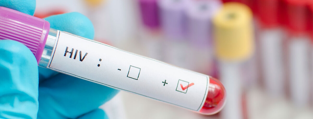 Imagem de É urgente acabar com o estigma e voltar a falar sobre VIH e SIDA