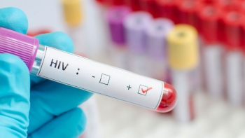 Imagem de É urgente acabar com o estigma e voltar a falar sobre VIH e SIDA