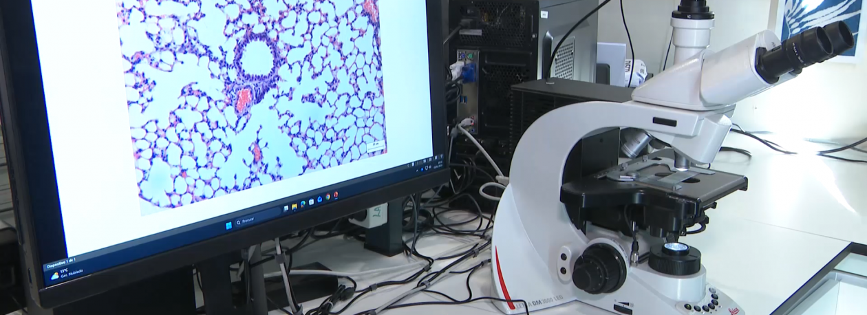 Imagem de Exposição a ambientes vulcânicos pode aumentar risco de problemas na tiróide