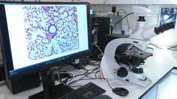 Imagem de Exposição a ambientes vulcânicos pode aumentar risco de problemas na tiróide