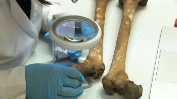 Imagem de Investigação revela altas concentrações de metais pesados em esqueletos provenientes do cemitério da Praia da Vitória