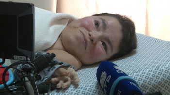 Imagem de Dia Mundial Doenças Raras: A História de Carmélia Carreiro