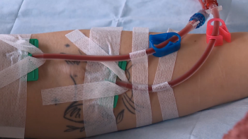 Imagem de APIR considera insuficientes garantias do Governo sobre funcionamento do Serviço de Hemodiálise no novo HDES