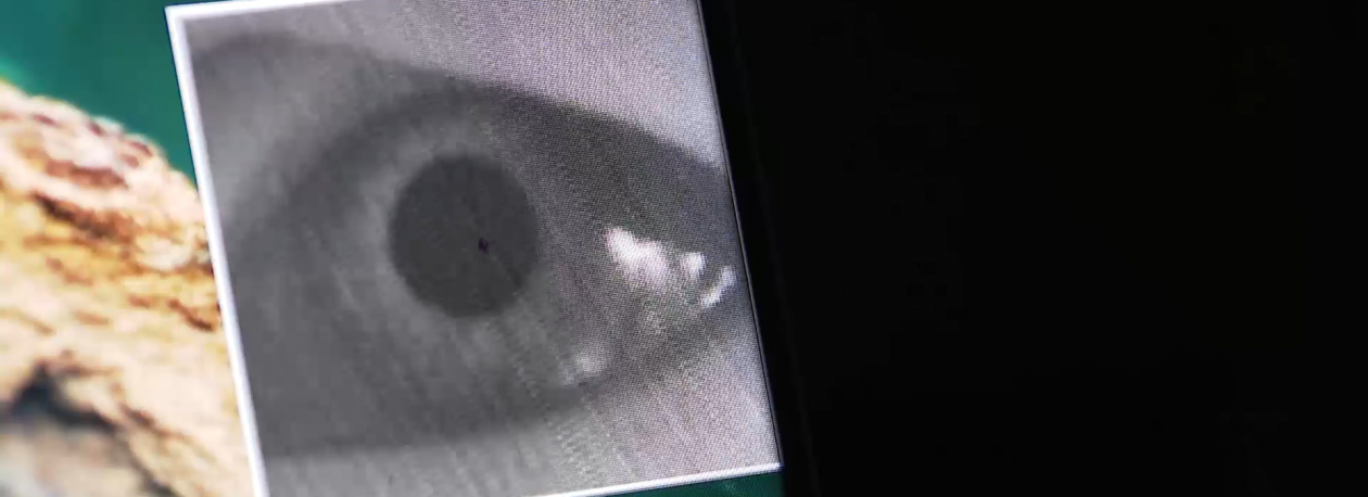 Imagem de Glaucoma afeta 4 mil pessoas nos Açores