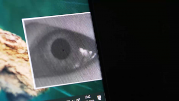Imagem de Glaucoma afeta 4 mil pessoas nos Açores