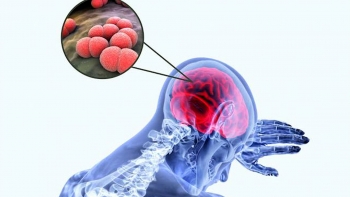Imagem de Caso de menigite detatado na Escola da Ribeirinha em São Miguel