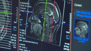 Imagem de Seidi discorda que prevenção da doença de Alzheimer se faça através de rastreios