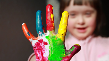 Imagem de Associação de Pais e Amigos das Crianças Deficientes dos Açores comemora 50º aniversário