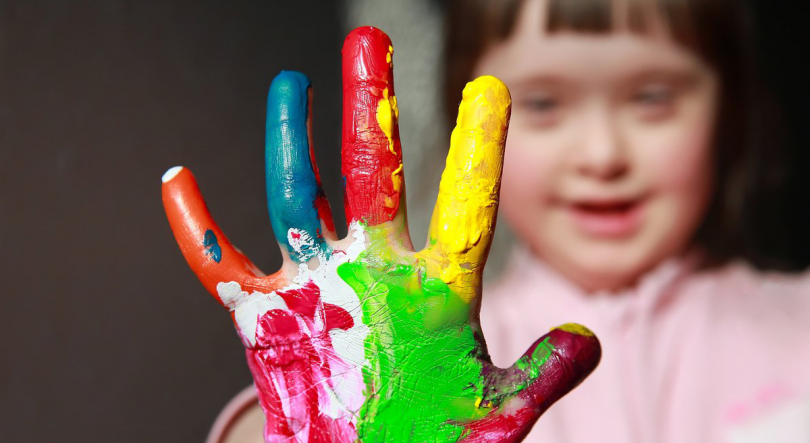 Imagem de Associação de Pais e Amigos das Crianças Deficientes dos Açores comemora 50º aniversário