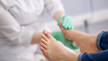 Imagem de Pé Diabético nos Açores: 30 amputações no primeiro trimestre do ano