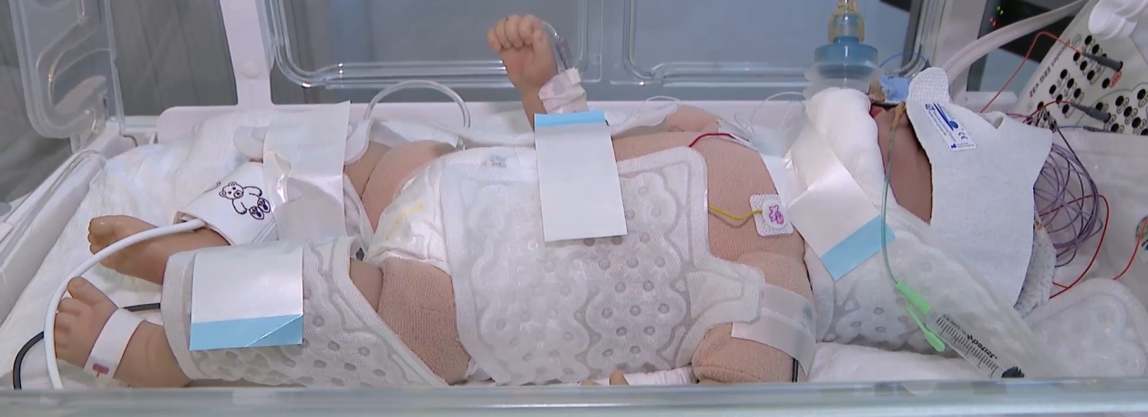 Imagem de Tratamento para recém-nascidos: Hipotermia induzida existe no HDES e salva vidas