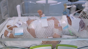 Imagem de Tratamento para recém-nascidos: Hipotermia induzida existe no HDES e salva vidas